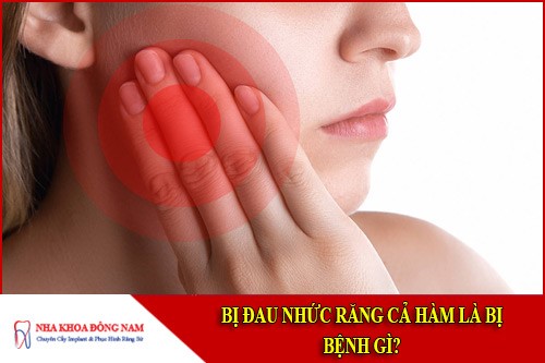 bị đau nhức răng cả hàm là bị bệnh gì