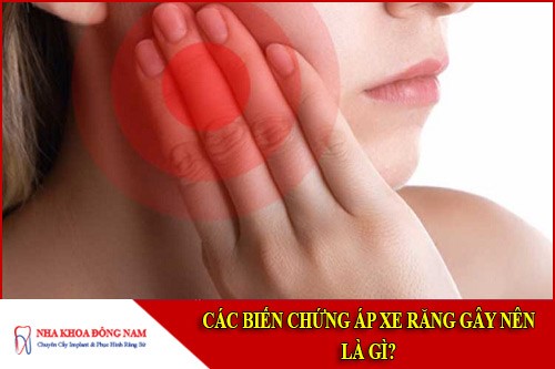 các biến chứng áp xe răng gây nên là gì