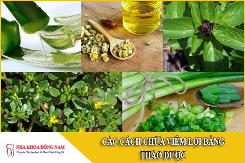 các cách chữa viêm lợi bằng thảo dược 6