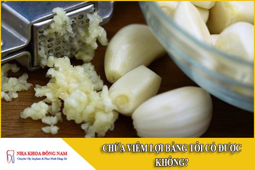 chữa viêm lợi bằng tỏi có được không