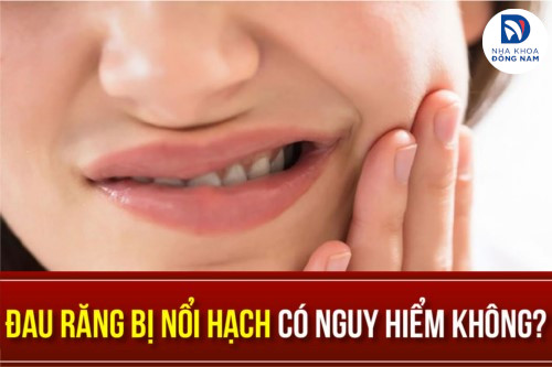 đau răng bị nổi hạch có nguy hiểm không