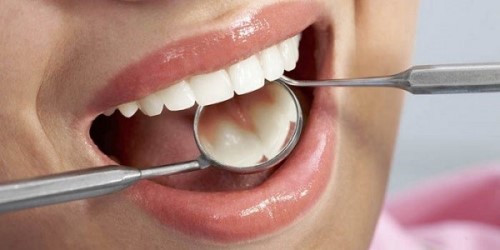 điều trị đau răng tại nha khoa