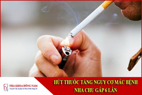 hút thuốc tăng nguy cơ mắc bệnh nha chu gấp 6 lần