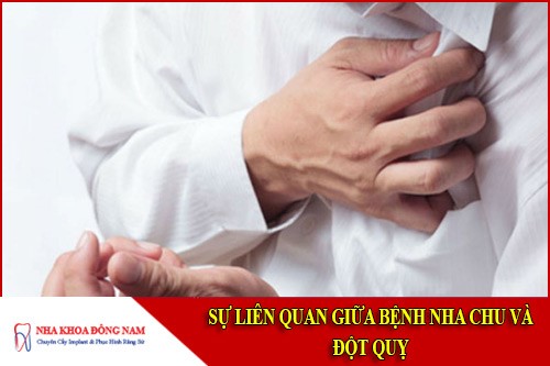 sự liên quan giữa bệnh nha chu và đột quỵ
