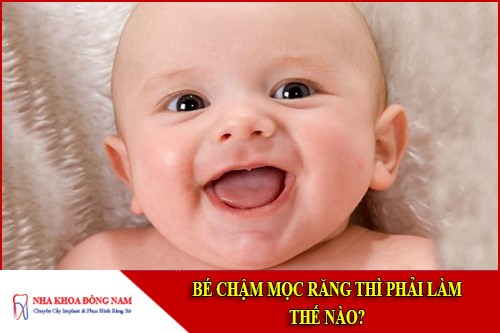 bé chậm mọc răng thì phải làm sao