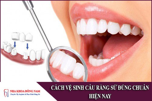 cách vệ sinh cầu răng sứ đúng chuẩn hiện nay