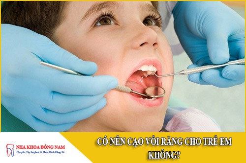 có nên cạo vôi răng cho trẻ em không