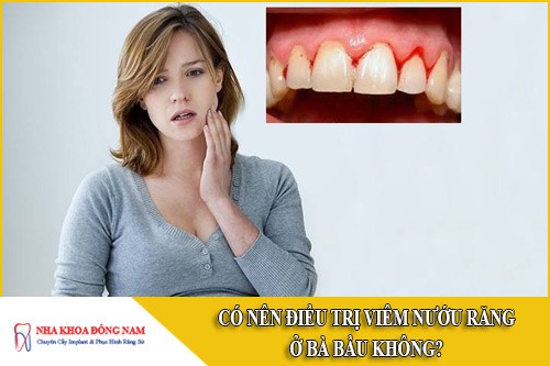 có nên điều trị viêm nướu răng ở bà bầu không