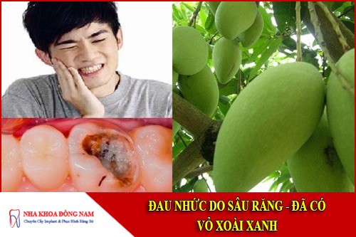 đau nhức do sâu răng đã có vỏ xoài xanh