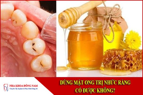 dùng mật ong trị nhức răng có được không