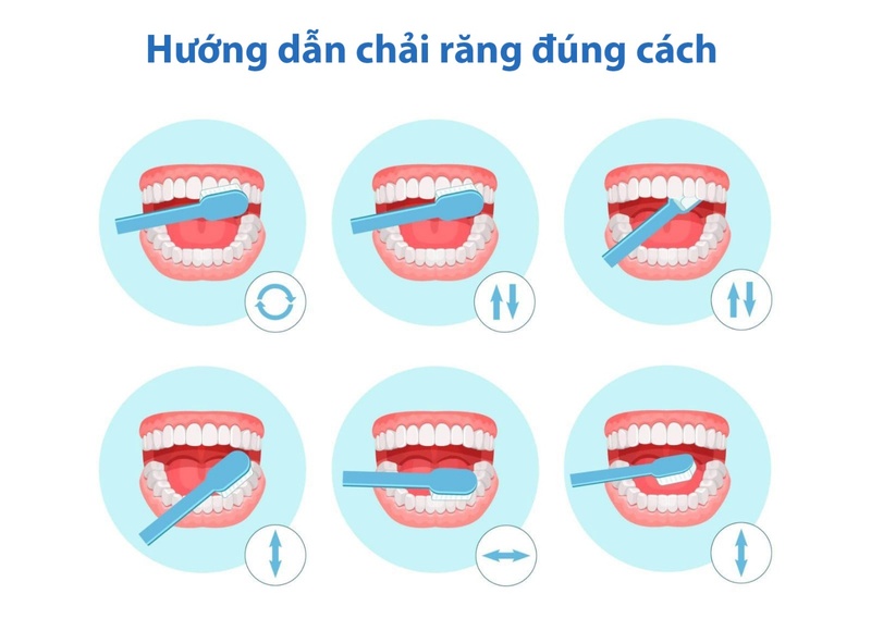 Hướng dẫn chải răng đúng cách
