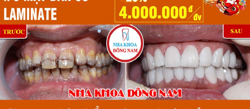 Khuyến mãi Mặt dán sứ lamintate nhân dịp noel và tết tây 2019