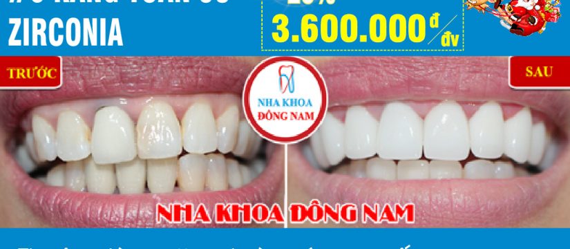 Khuyến mãi răng toàn sứ Zirconia nhân dịp noel và tết tây 2019