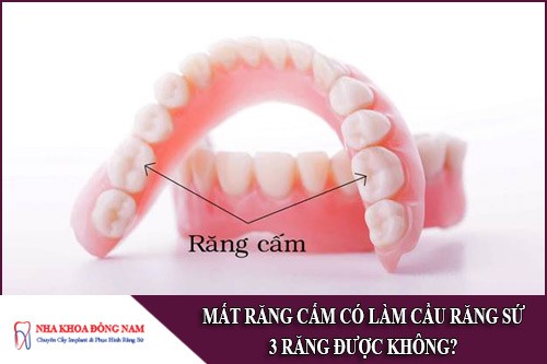 mất răng cấm có làm cầu răng sứ 3 răng được không