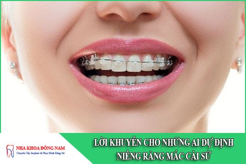 niềng răng mắc cài sứ