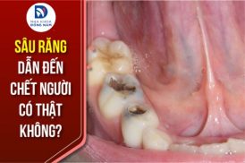 sâu răng dẫn đến chết người có thật không