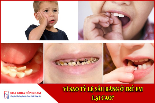 vì sao tỉ lệ sâu răng ở trẻ em lại cao