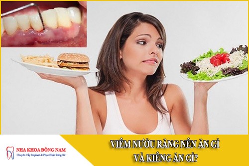 viêm nướu răng nên ăn gì và kiêng ăn gì