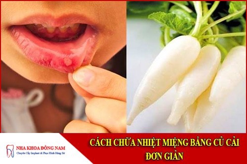 cách chữa nhiệt miệng bằng củ cải đơn giản