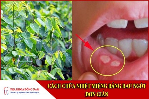 cách chữa nhiệt miệng bằng rau ngót