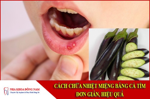 cách chữa nhiệt miệng với cà tím