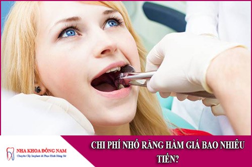 chi phí nhổ răng hàm giá bao nhiêu tiền