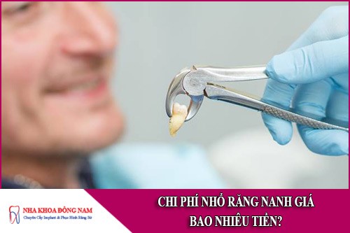 chi phí nhổ răng nanh giá bao nhiêu tiền