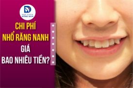 chi phí nhổ răng nanh giá bao nhiêu tiền