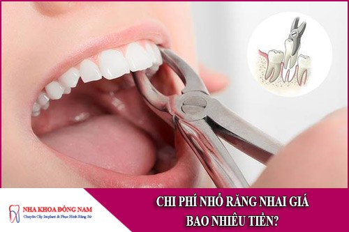 chi phí nhổ răng nhai giá bao nhiêu tiền