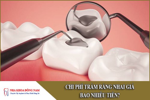 chi phí trám răng nhai giá bao nhiêu tiền