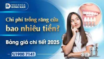 Chi phí trồng răng cửa bao nhiêu tiền? Bảng giá chi tiết 2025