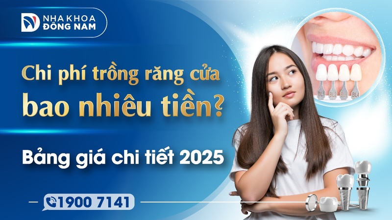 Chi phí trồng răng cửa bao nhiêu tiền? Bảng giá chi tiết 2025