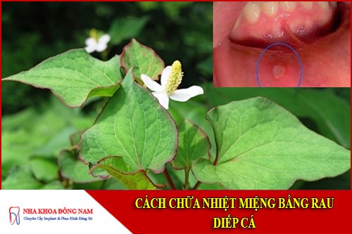cách chữa nhiệt miệng bằng rau diếp cá