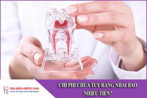 chi phí chữa tủy răng nhai bao nhiêu tiền