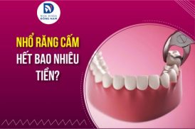 nhổ răng cấm hết bao nhiêu tiền