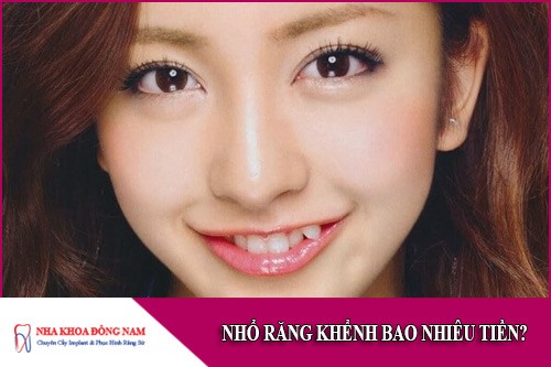 nhổ răng khểnh bao nhiêu tiền