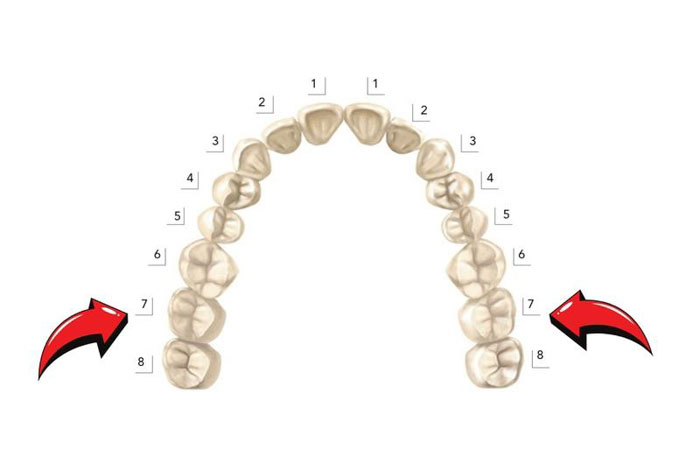 Răng nhai là các răng nằm ở vị trí 6, 7