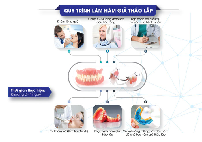 Thời gian làm răng giả tháo lắp chỉ mất tầm 2 – 4 ngày là hoàn tất