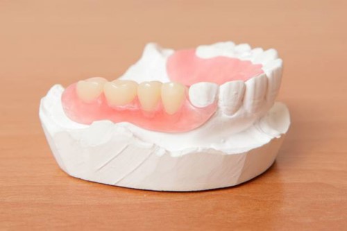 trồng răng nhai bằng hàm tháo lắp