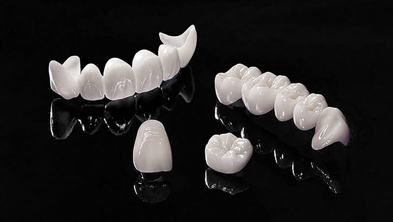 Cấu tạo răng sứ toàn sứ
