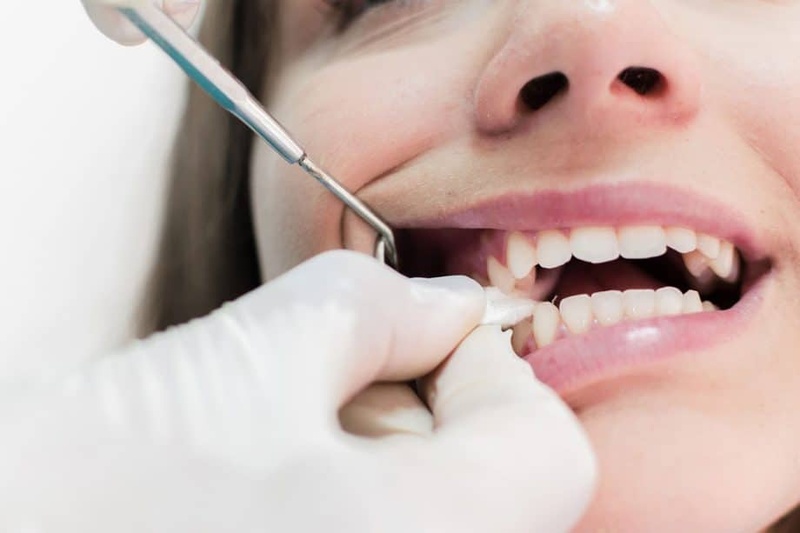 Cắn gạc cầm máu sau khi nhổ răng