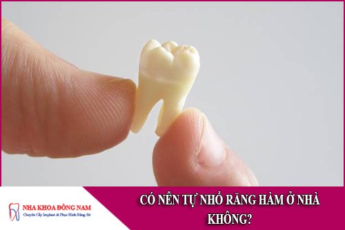 có nên tự nhổ răng hàm ở nhà không