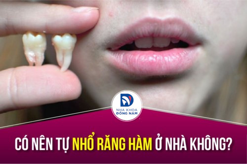 Có nên tự nhổ răng hàm ở nhà không?