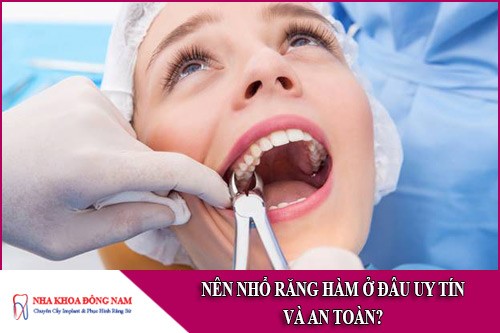 nên nhổ răng hàm ở đâu uy tín và an toàn