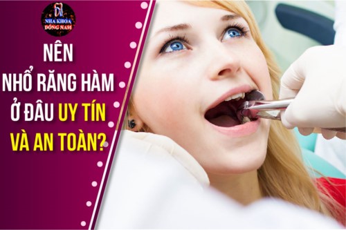 nên nhổ răng hàm ở đâu uy tín và an toàn