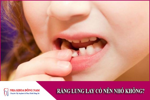 răng lung lay có nên nhổ không