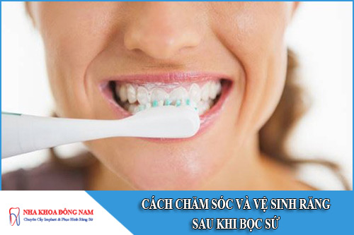 cách chăm sóc và vệ sinh răng sau khi bọc sứ