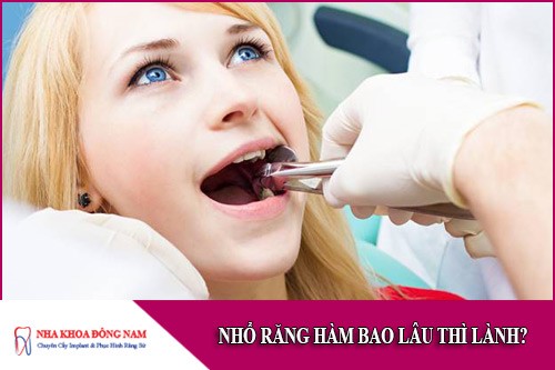 nhổ răng hàm bao lâu thì lành