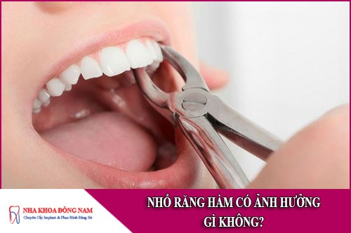 Nhổ răng hàm có ảnh hưởng gì không