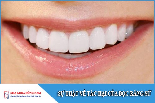sự thật về tác hại của bọc răng sứ